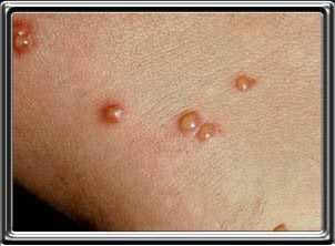 Chemdry central sydney: Carpet cleaning